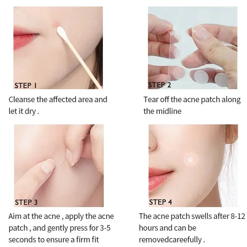 72-720Pcs Invisible Acne Patches Removal Pimple Anti-Acne Hydrocolloid Patches Spots Marks Concealer Repair Sticker Waterproof